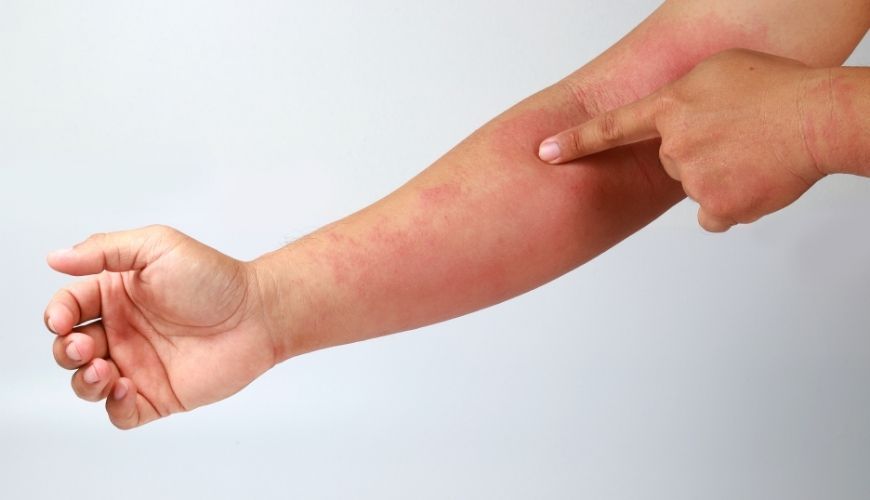 Pell amb problemes dermatològics