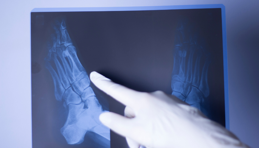 Cirurgia-Intensiva-Traumatologia