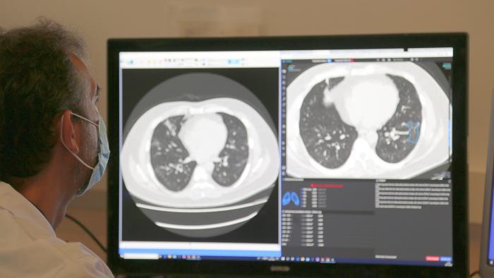 inteligencia artificial tac