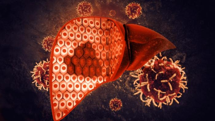 Tumor hepàtic pediàtric