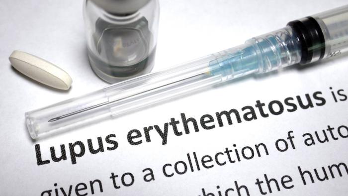 Lupus eritematos
