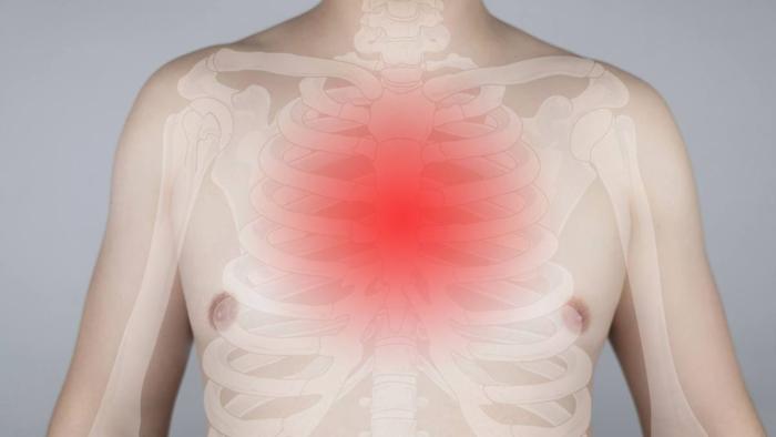 Miopatia Inflamatoria