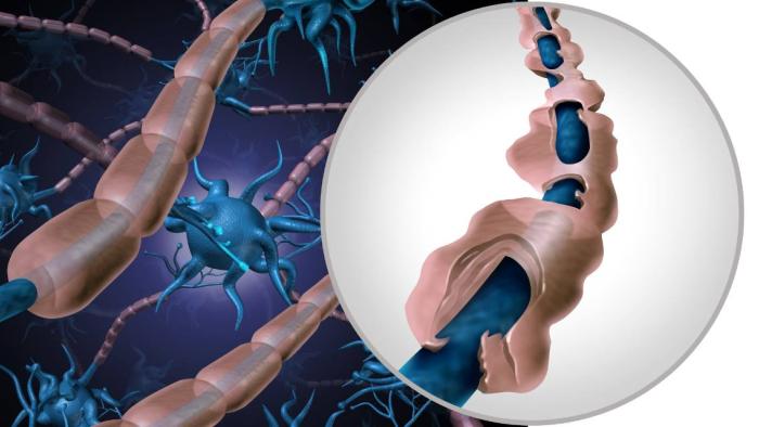 Esclerosi Multiple Tractament