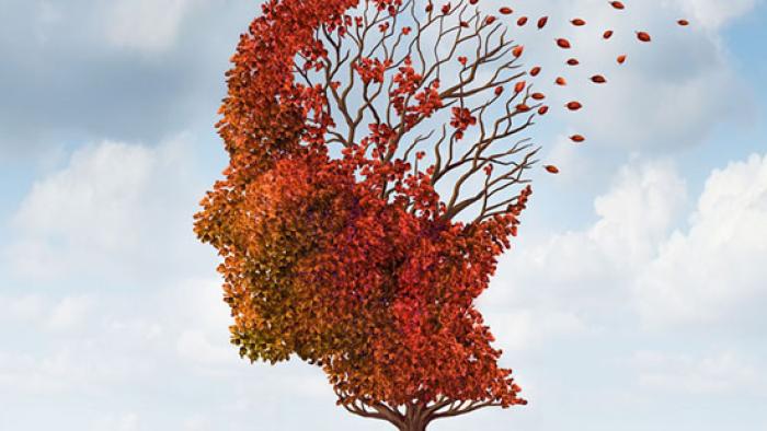 Malaltia d'Alzheimer a Vall d'Hebron