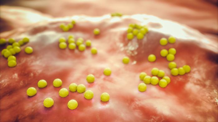 endocarditis aguda Vall d'Hebron