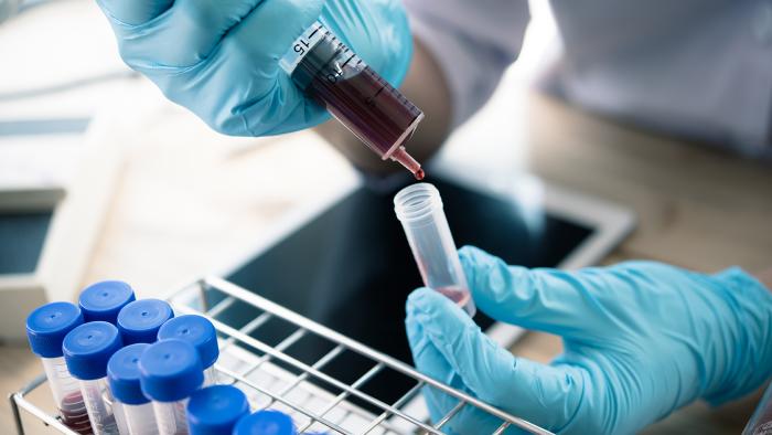 Deficiències de factor poc comunes Vall d'Hebron