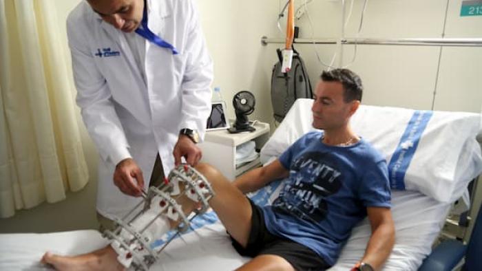 traumatismes, osteogenesis, CSUR, reconstrucció defectes ossis,