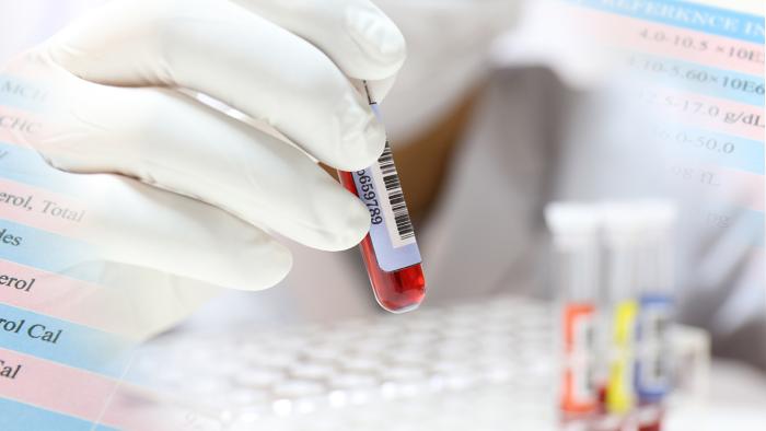 hepatitis crònica Vall d Hebron