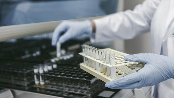 proves diagnòstiques de malalties renals Vall d'Hebron