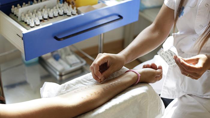 Proves cutànies d'al•lèrgia Vall d´Hebron