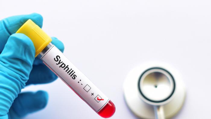 Sífilis