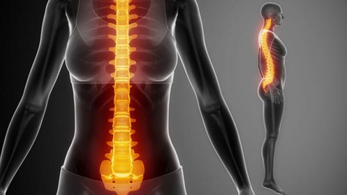 Síndromes de la fallada medul·lar congènita a Vall d'Hebron 