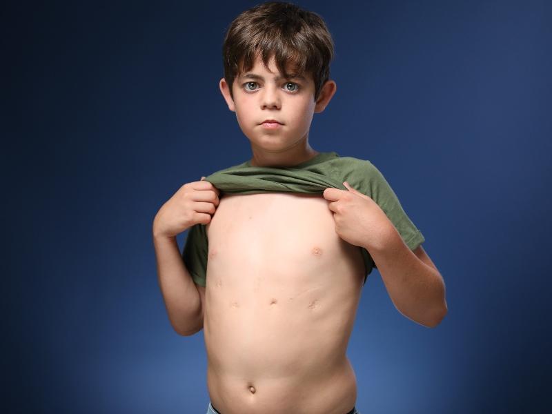 El David va rebre un trasplant de cor als 7 anys