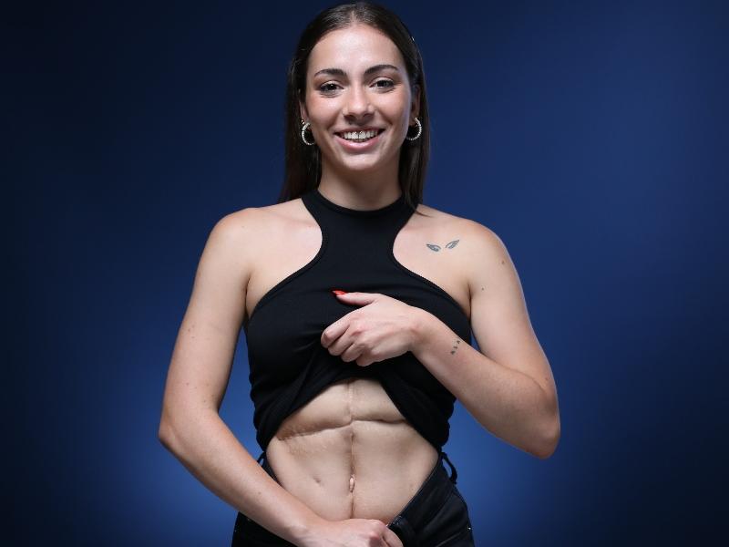 La Raquel, trasplantada amb cinc mesos, mostra la seva cicatriu