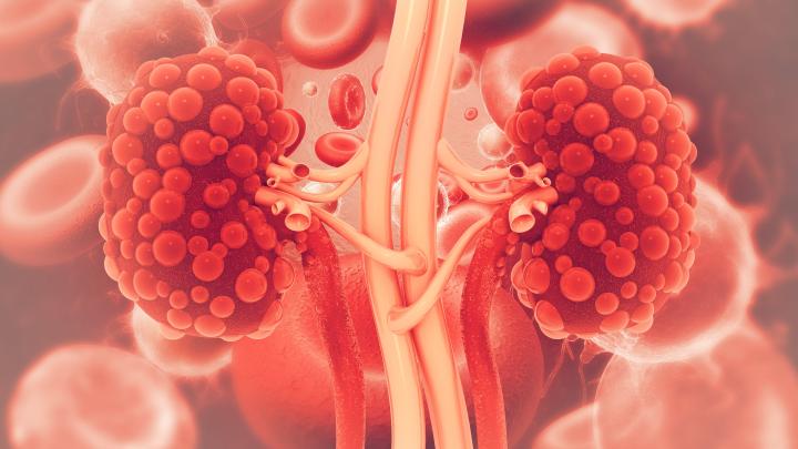 Trasplantament Renal