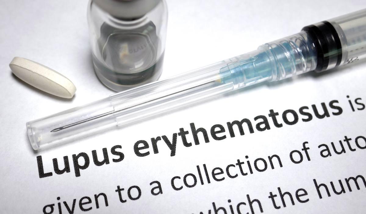 Lupus eritematos