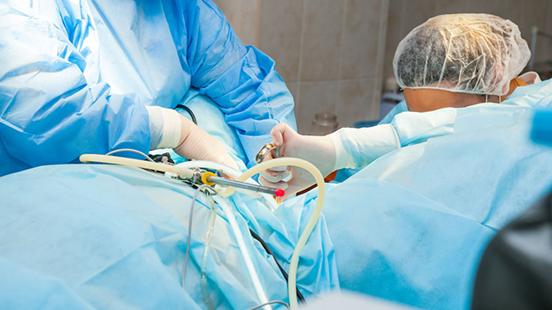 Miomectomia laparoscòpica a Vall d'Hebron