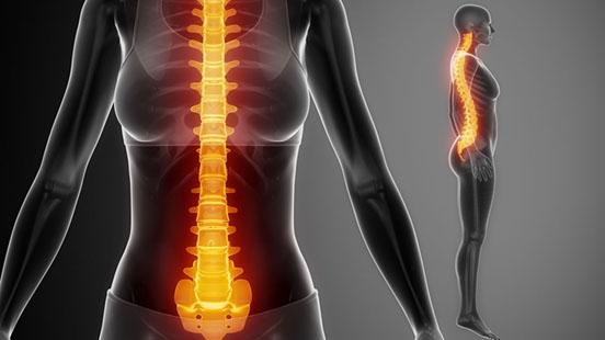 Síndromes de la fallada medul·lar congènita a Vall d'Hebron 