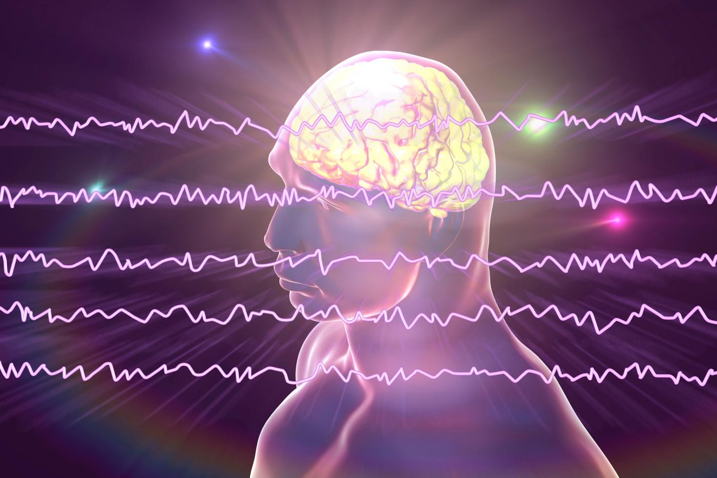 Teràpia electroconvulsiva